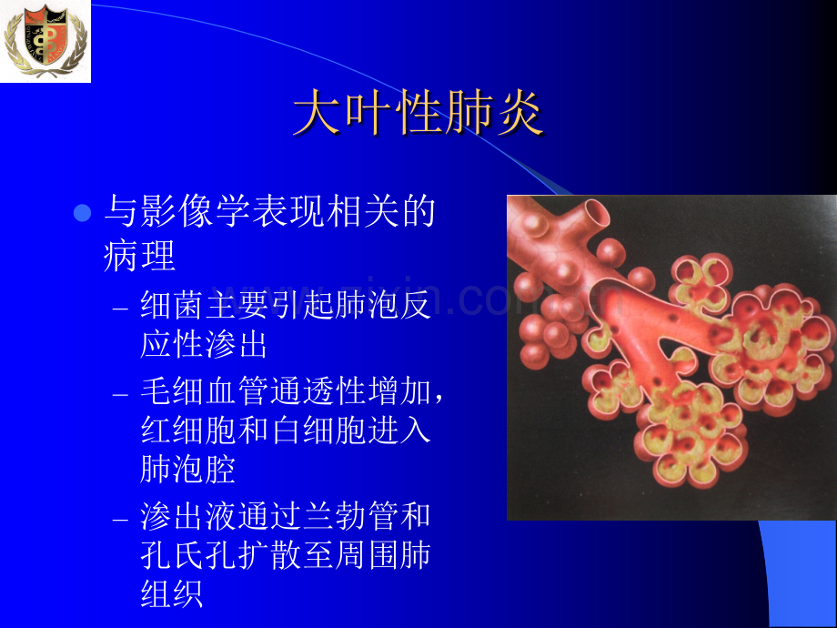 肺部炎症影像诊断-(2)ppt课件.ppt_第3页