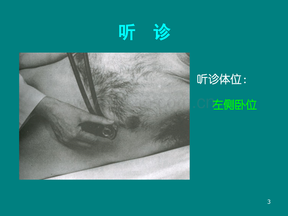 诊断学心脏检查听诊.ppt_第3页