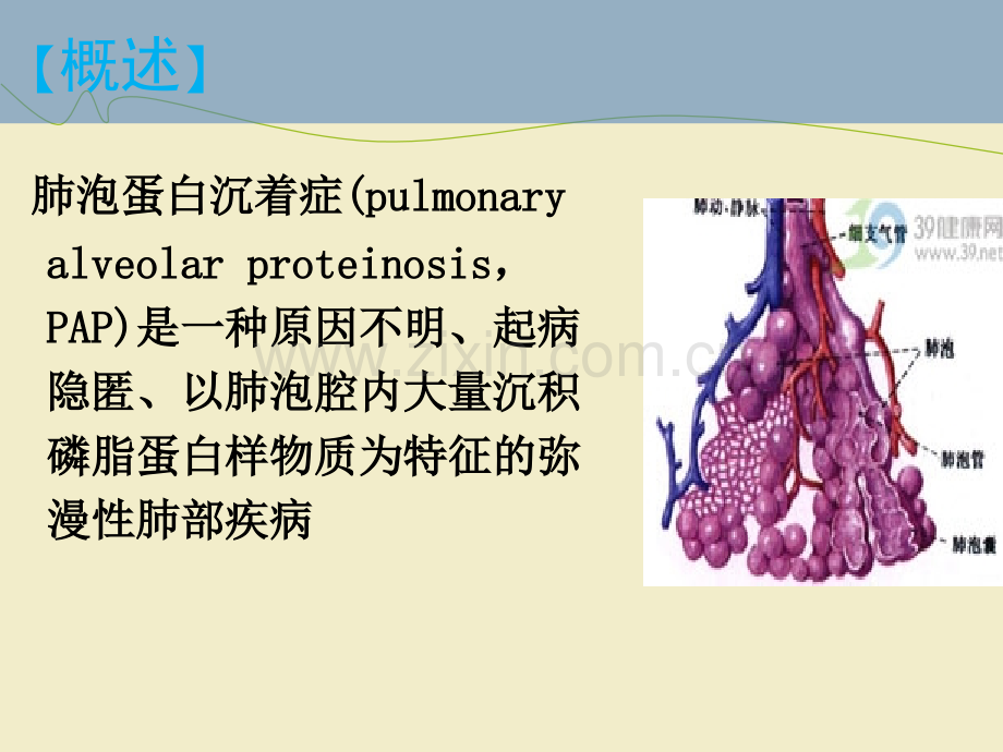 肺泡蛋白沉着症影像表现ppt课件(1).ppt_第3页