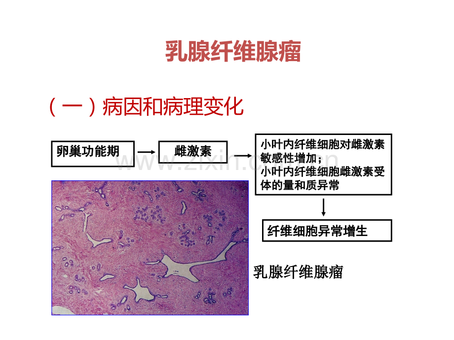 常见乳腺肿瘤的影像表现.ppt_第3页