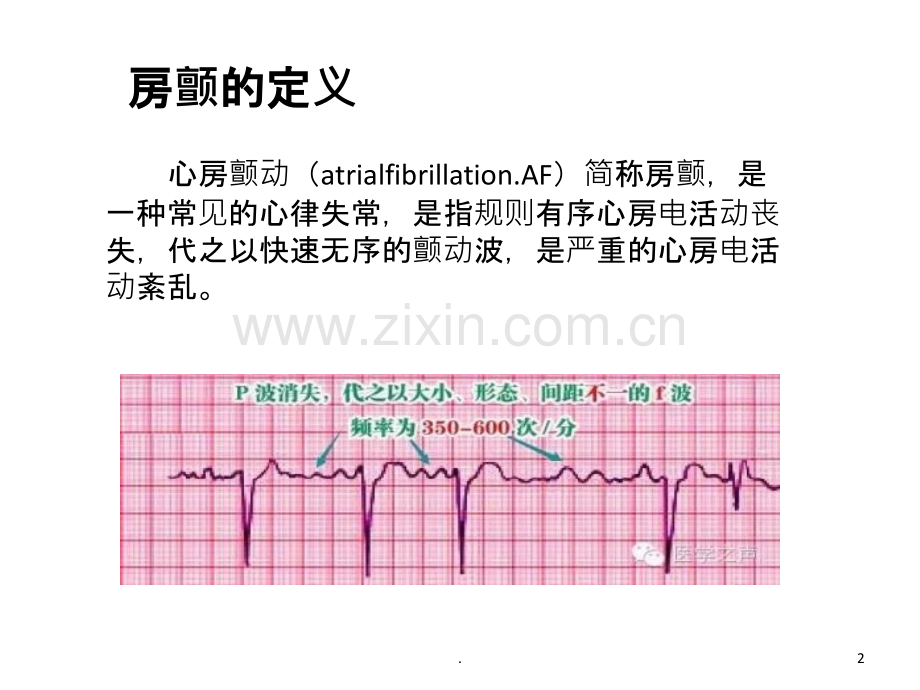 房颤治疗策略课件.ppt_第2页