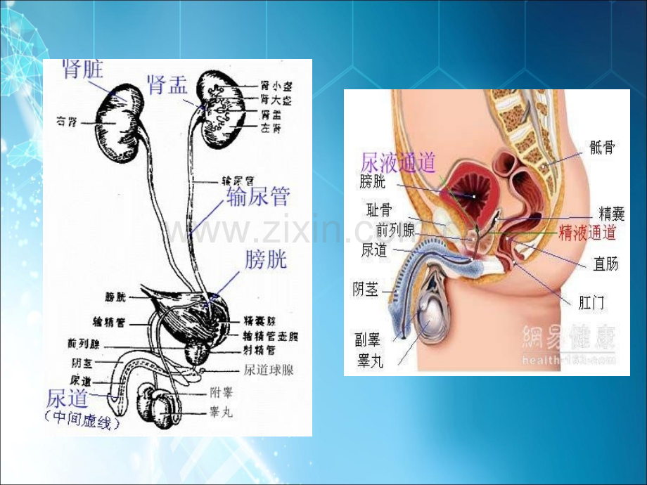 膀胱癌病人的护理ppt课件.ppt_第3页