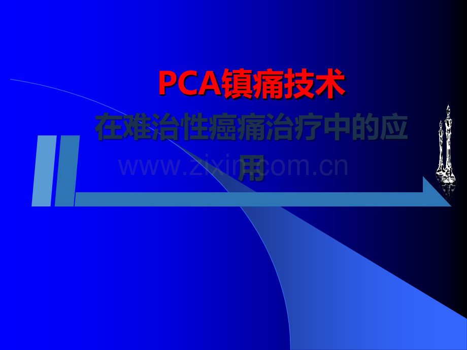 CA镇痛技术在难治性癌痛治疗中的应用ppt课件.ppt_第1页