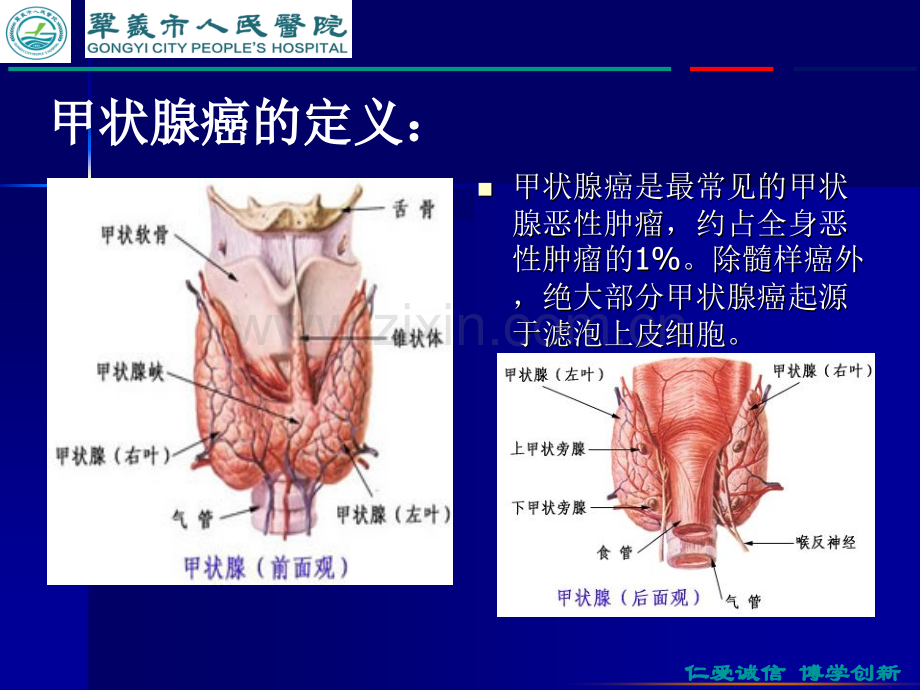 甲状腺癌教学查房-胸心外科ppt课件.pptx_第2页