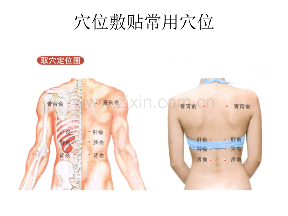 冬病夏治贴敷综合治疗支气管哮喘技术ppt课件.ppt_第3页