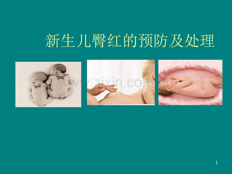 新生儿臀红的预防及护理PPT课件.ppt_第1页