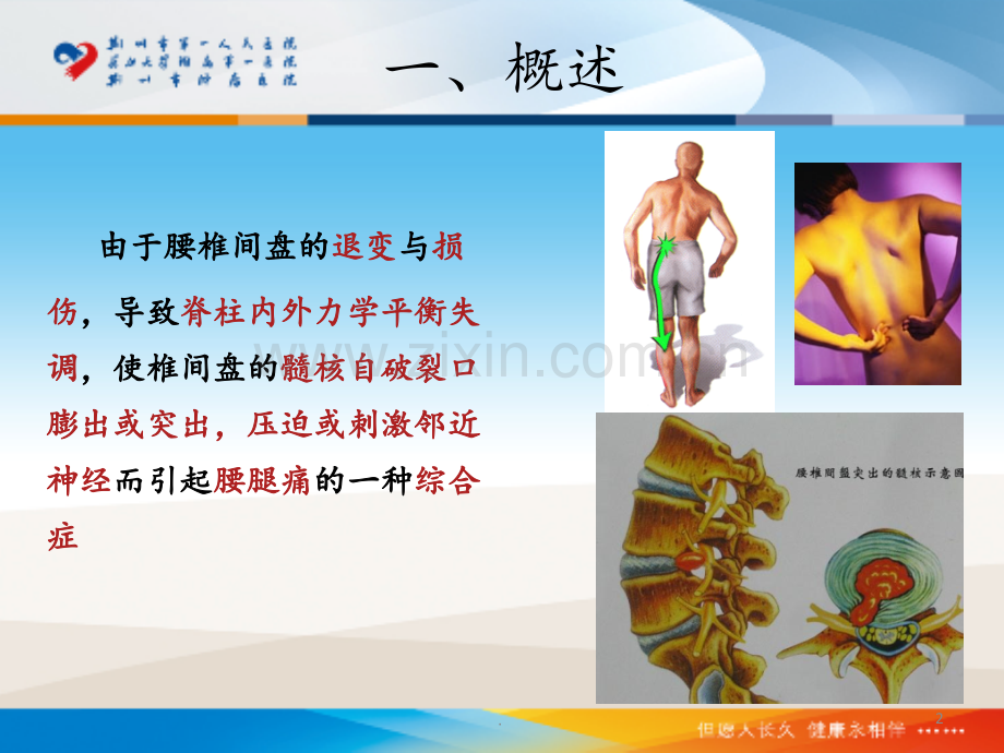 腰椎间盘突出症的注射治疗PPT课件.ppt_第2页