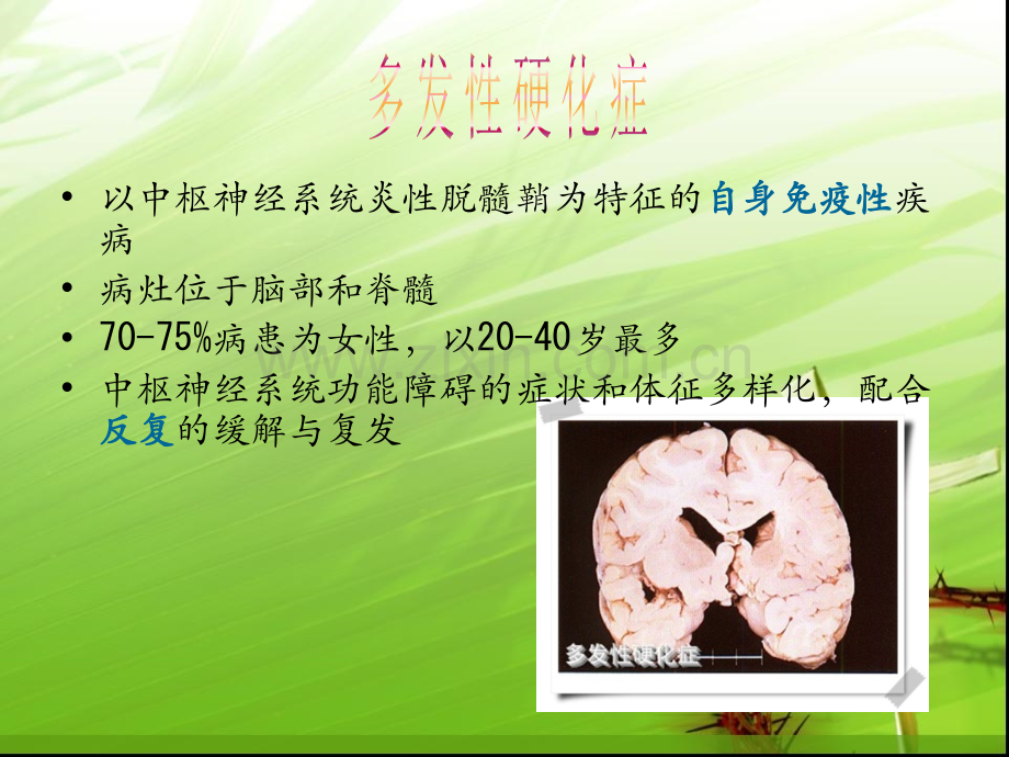 多发性硬化症ppt课件.ppt_第2页