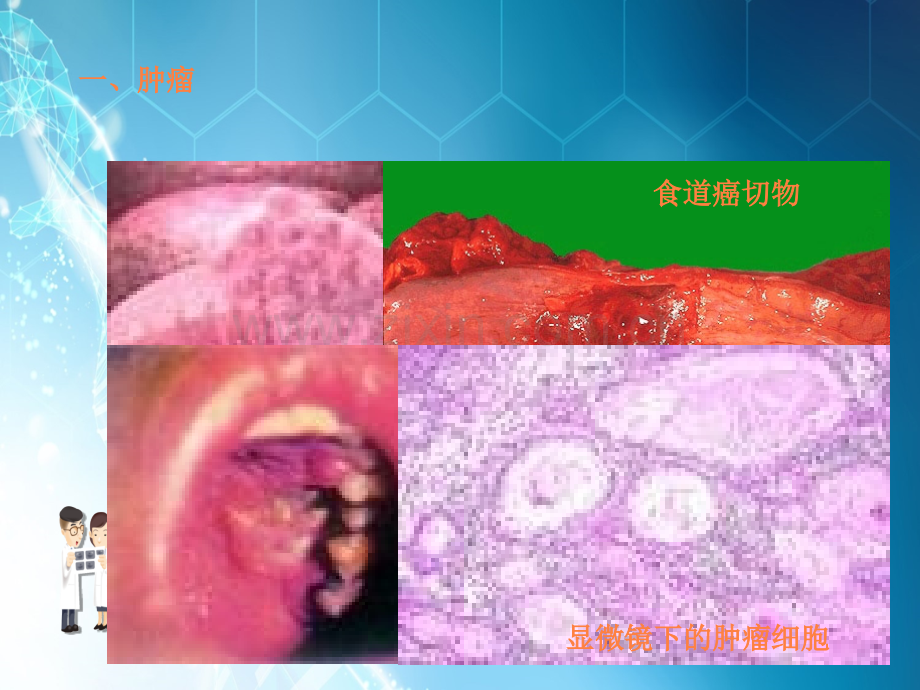 第四节-非传染性疾病ppt课件.ppt_第2页