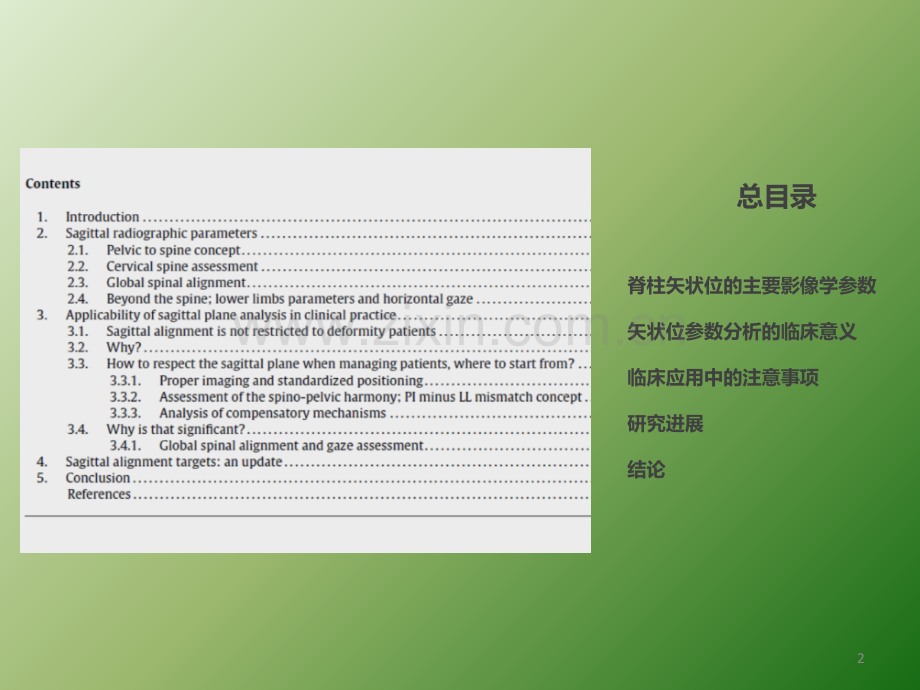 脊柱矢状位影像学参数及临床意义ppt课件.pptx_第2页