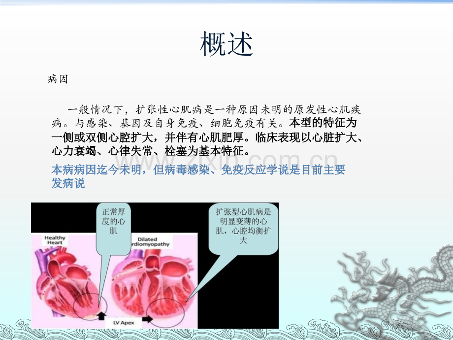 扩张型心肌病ppt课件.pptx_第3页