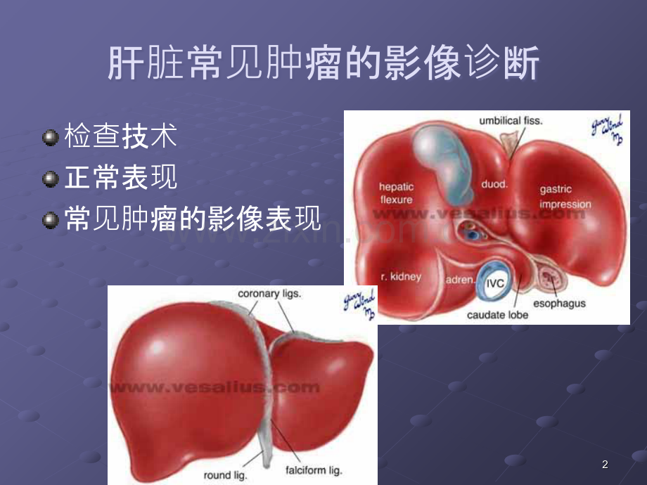 肝脏肿瘤的影像诊断ppt课件.ppt_第2页