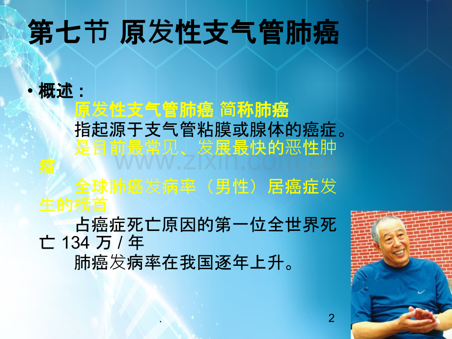 原发性支气管肺癌ln.ppt_第2页