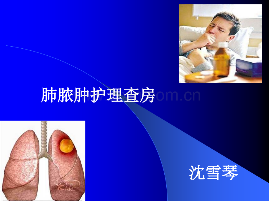 肺脓肿护理查房ppt课件.ppt_第1页