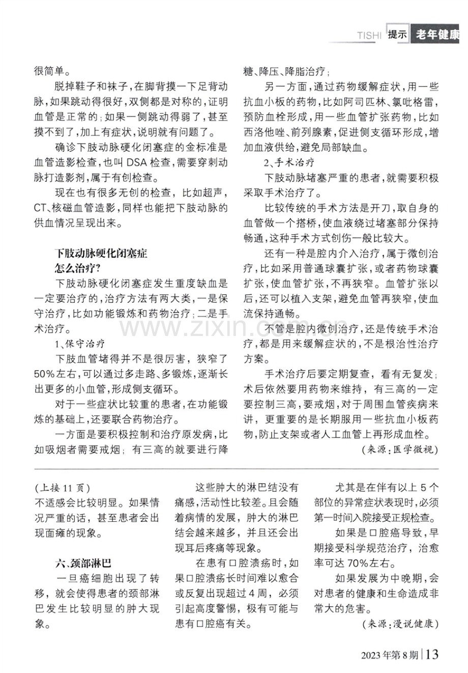 脑梗、心梗,还有“腿梗”.pdf_第2页