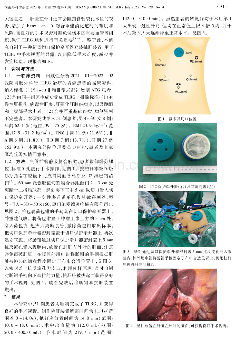 全腹腔镜根治性全胃切除术中应用自制切口保护牵开器套装挑肝装置效果分析.pdf_第2页