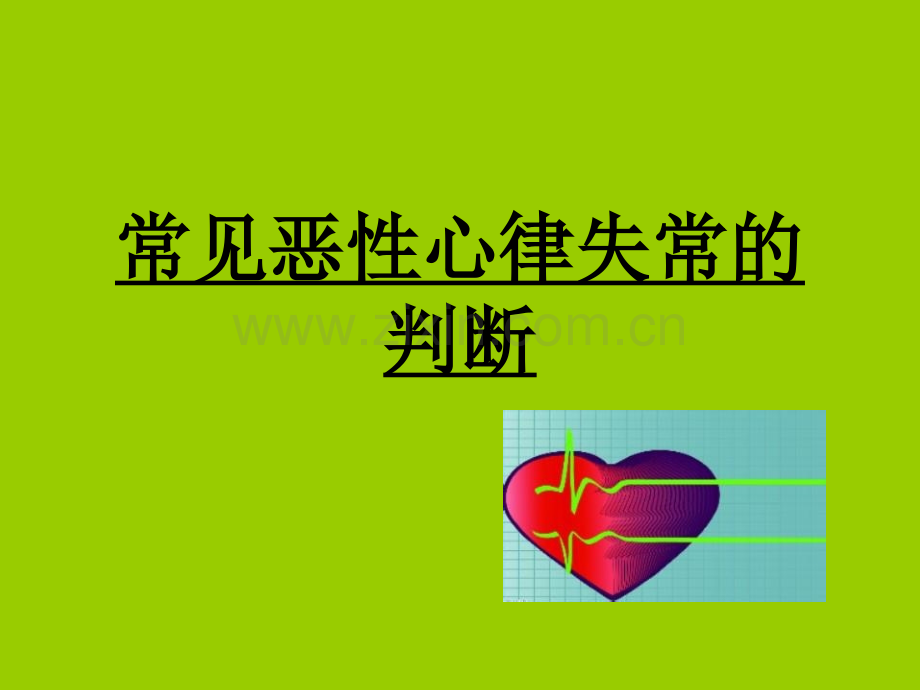 常见恶性心律失常.ppt_第1页