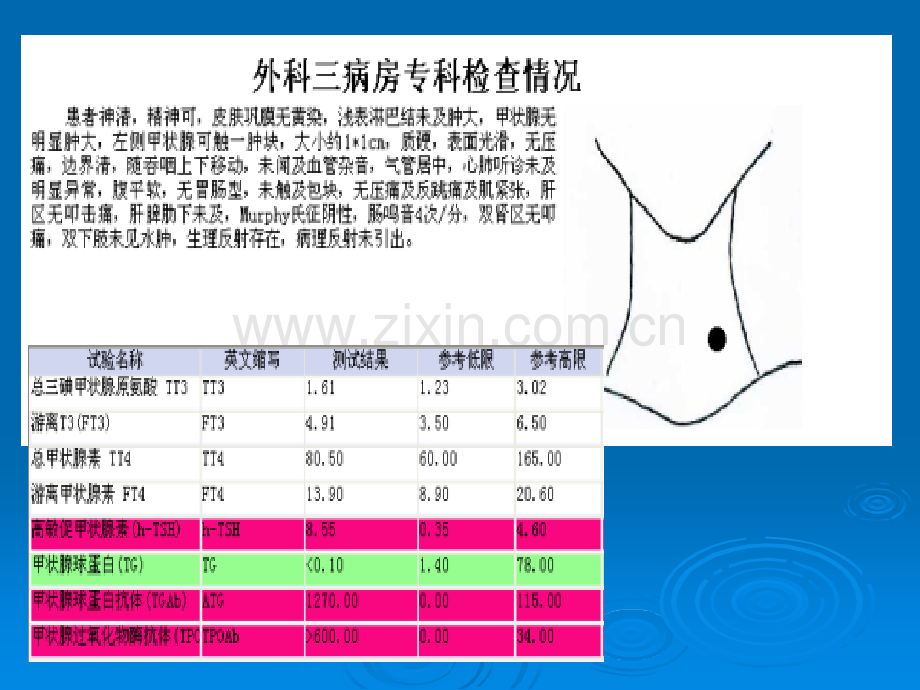 甲状腺结节诊断与治疗ppt课件.pptx_第3页