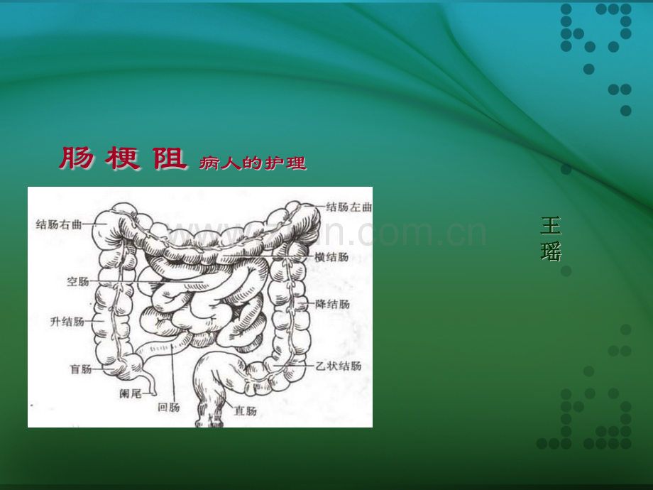 外科护理学肠梗阻病人的护理ppt课件.pptx_第1页