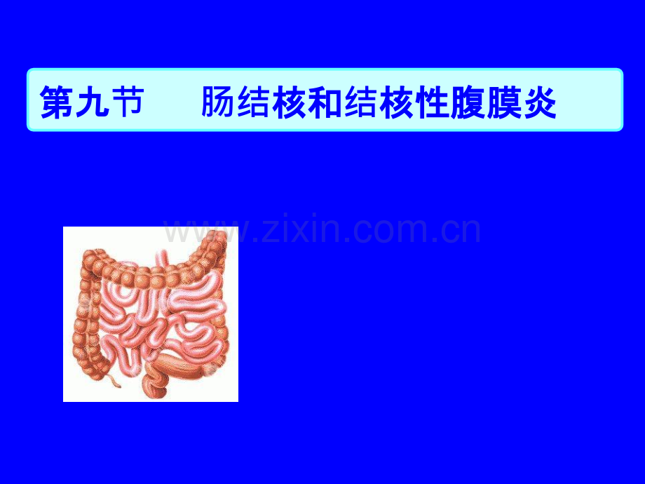 肠结核和结核性腹膜炎-ppt课件.ppt_第2页