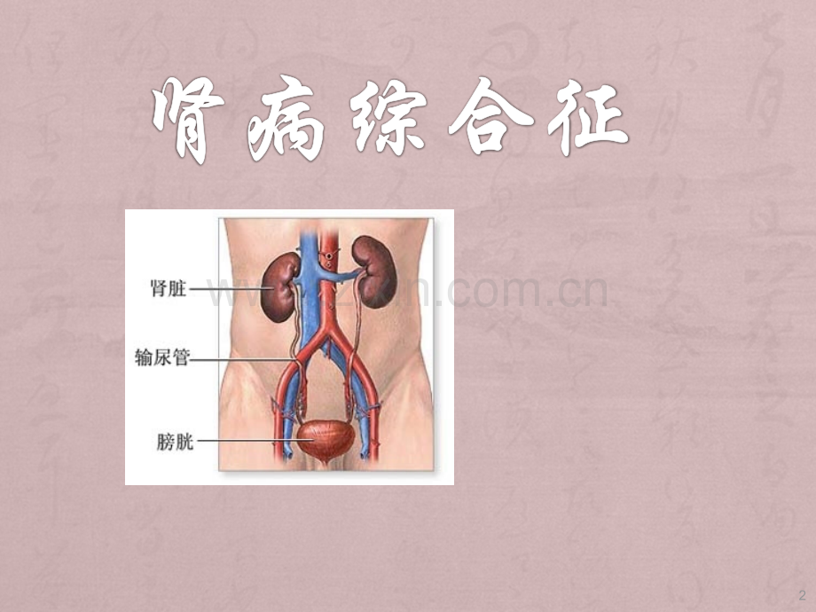 小儿肾病综合征PPT课件.ppt_第2页