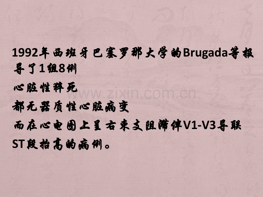 Brugada综合征课件.ppt_第2页