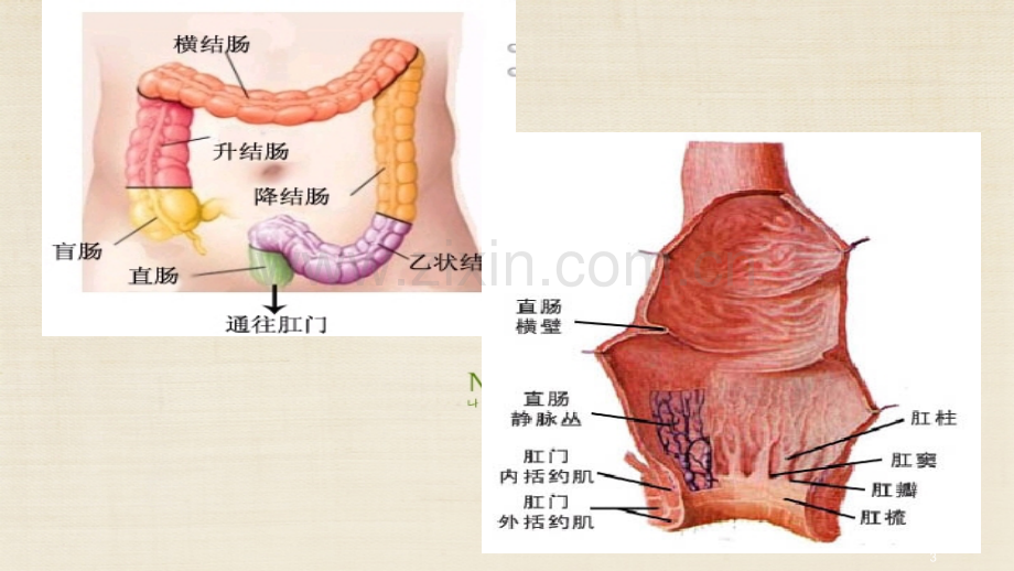 直肠癌手术护理PPT课件.ppt_第3页