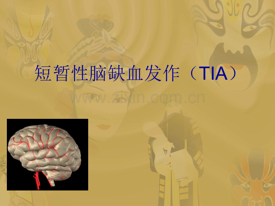 IA的鉴别与诊断ppt课件.ppt_第1页