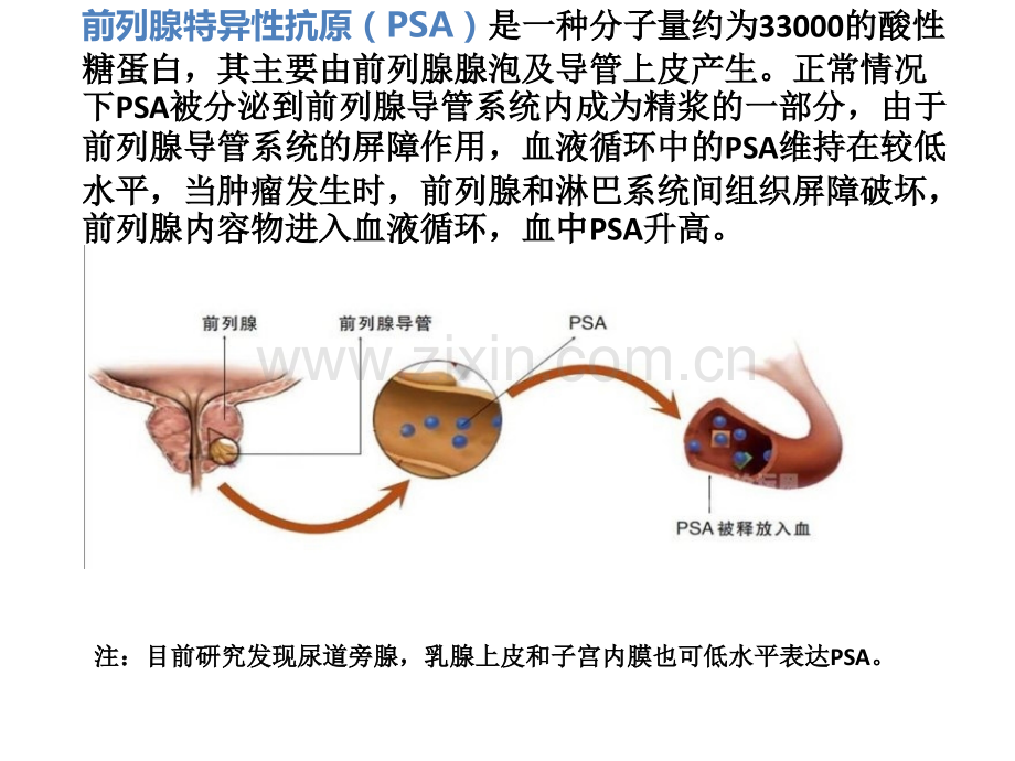 前列腺特异性抗原PSAppt课件.pptx_第2页