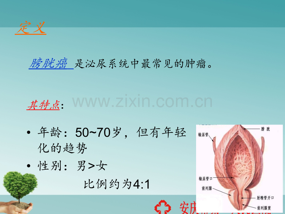 膀胱癌病人护理ppt课件.ppt_第2页