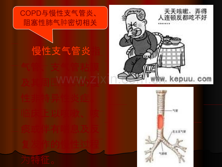 COPD慢阻肺的管理.ppt_第3页