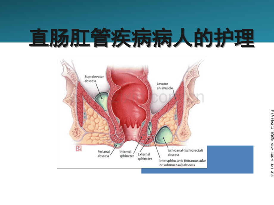 直肠肛管疾病病人的护理.ppt_第3页