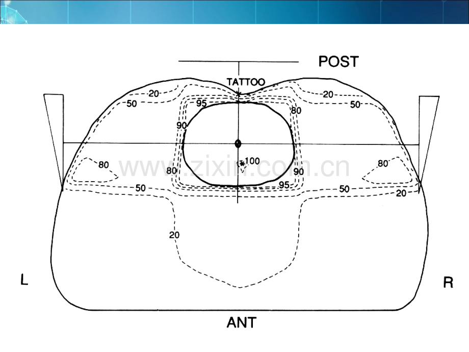 腹部消化系统肿瘤pptppt课件.ppt_第2页