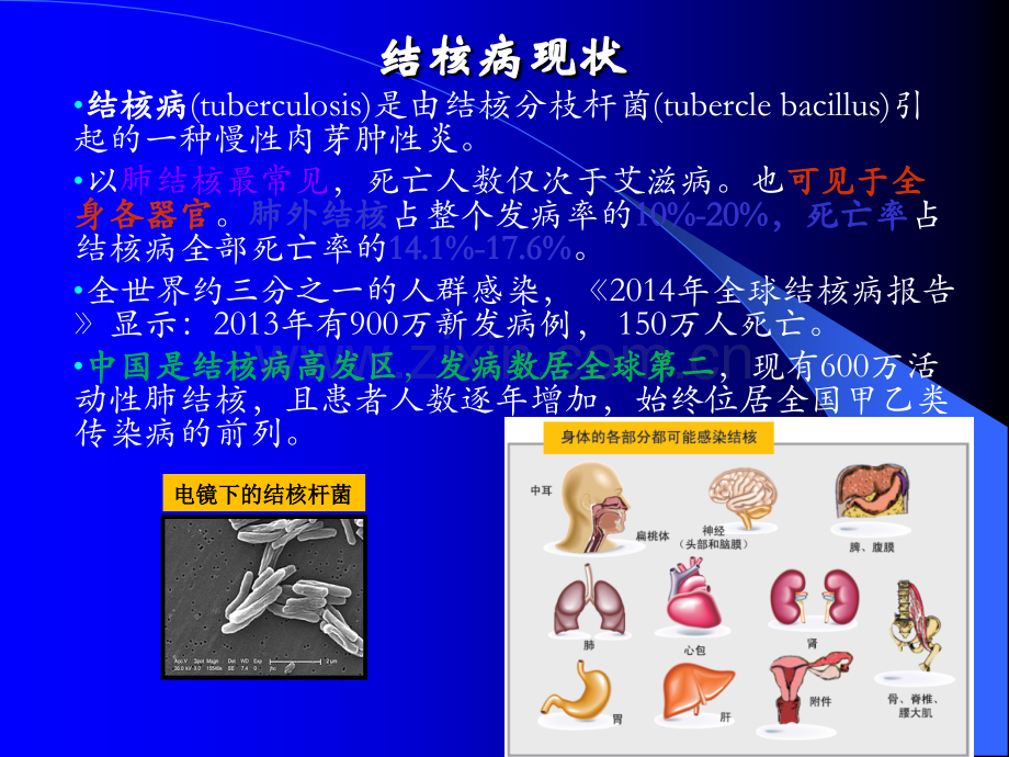 结核感染细胞检测呼吸科ppt课件.pptx_第3页