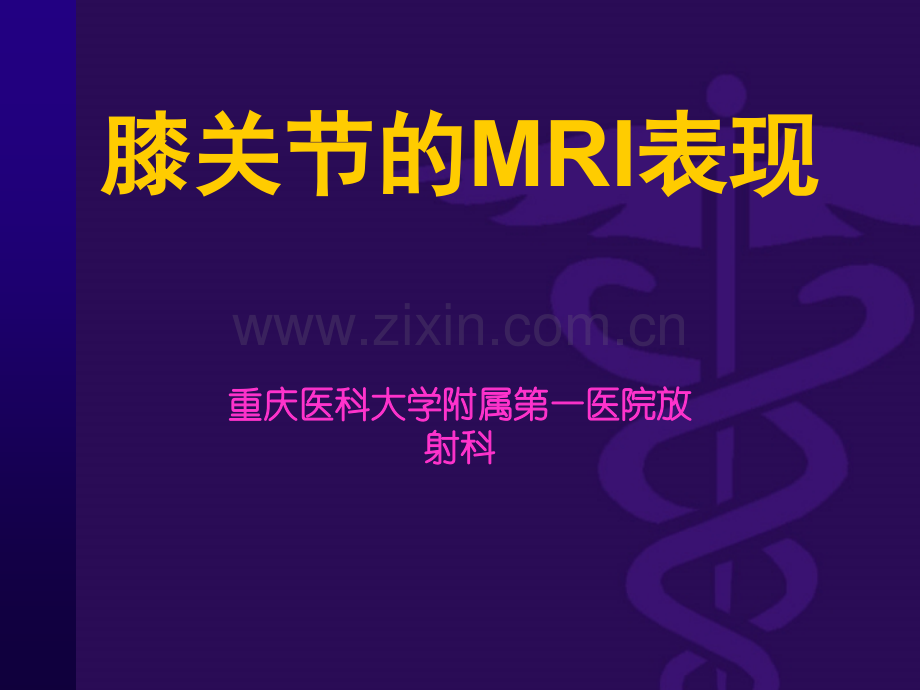 膝关节的MRI表现.ppt_第2页