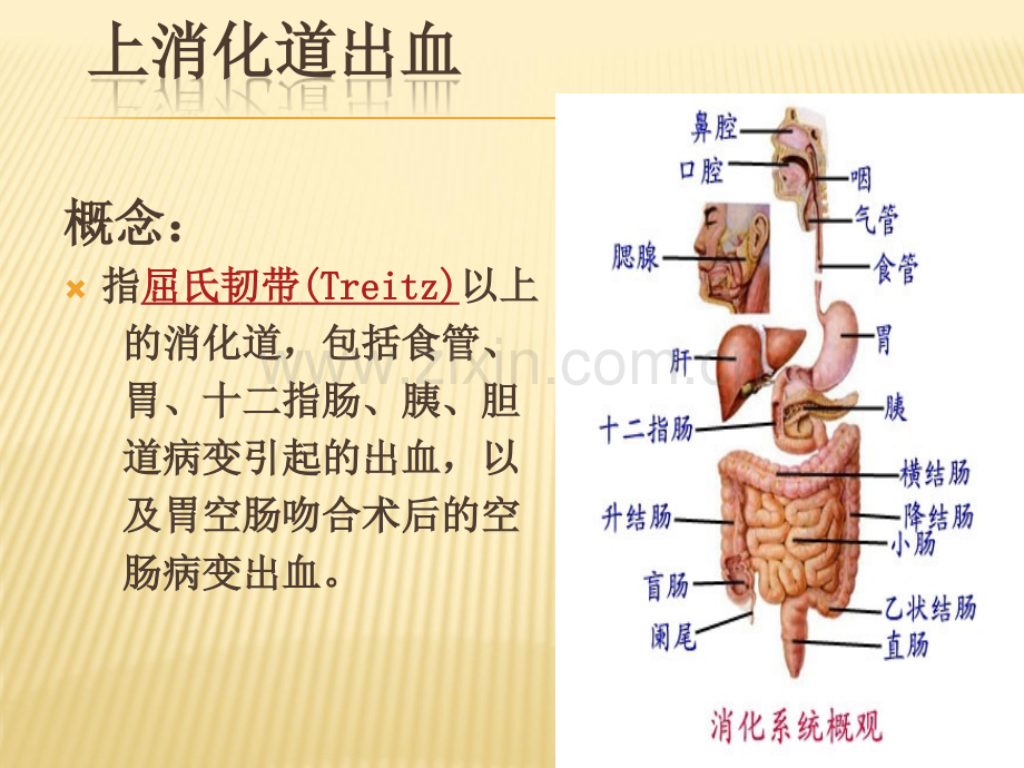 上消化道出血的护理ppt课件.pptx_第3页