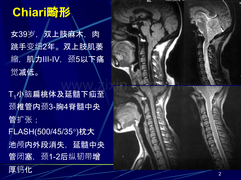 MRI图像-脑ppt课件.ppt_第2页