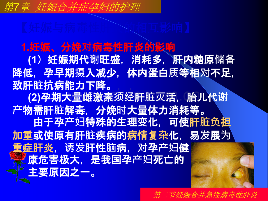 第二节妊娠合并病毒性肝炎患者的护理ppt课件.ppt_第2页