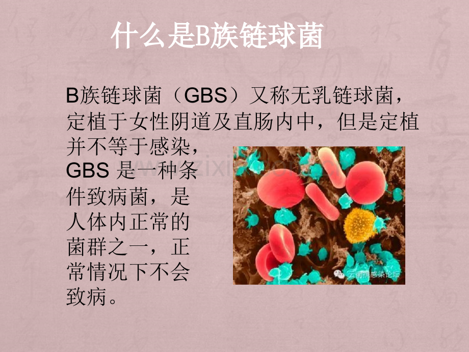 B族链球菌.ppt_第2页