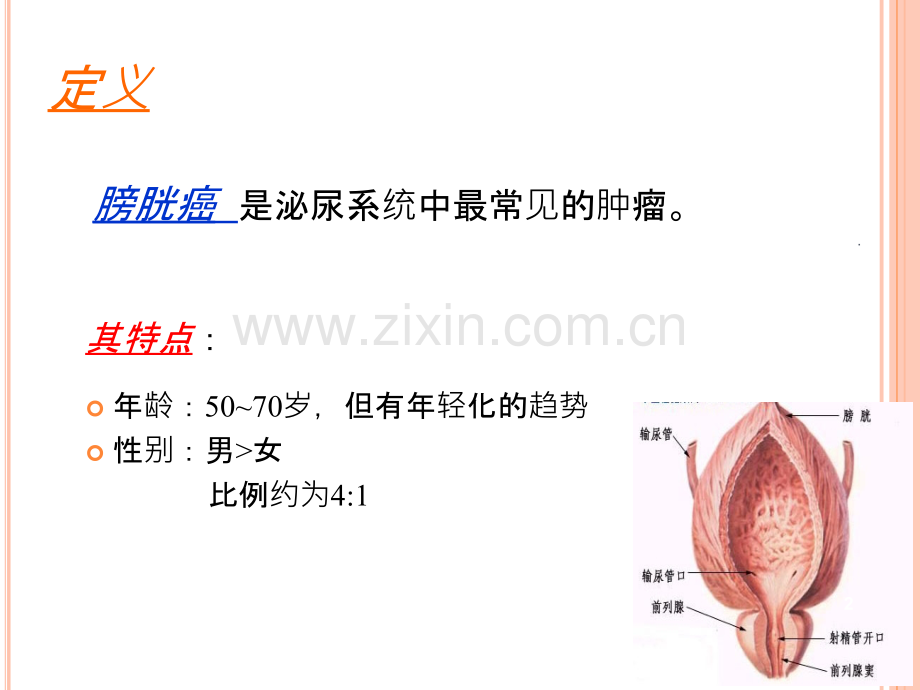 膀胱癌病人护理.ppt_第2页