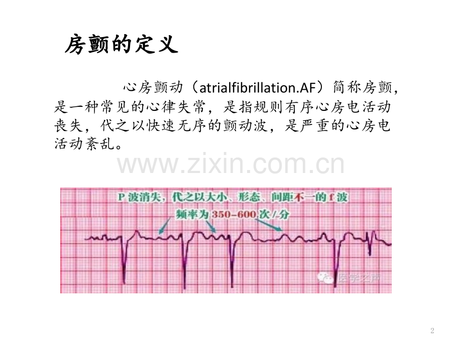 房颤治疗策略PPT课件.pptx_第2页