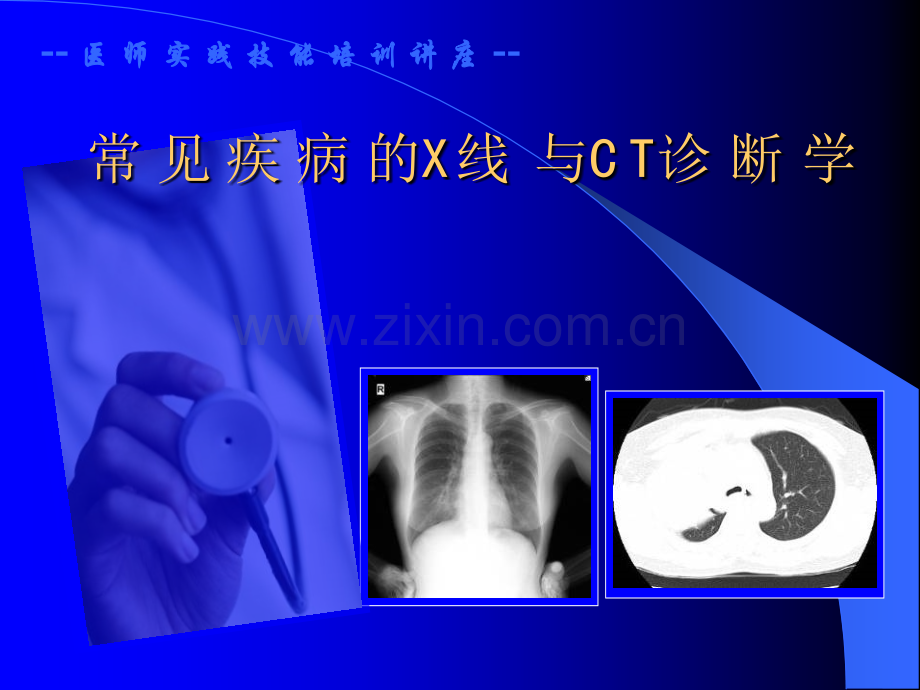 常见的X线和CT诊断ppt课件.ppt_第1页