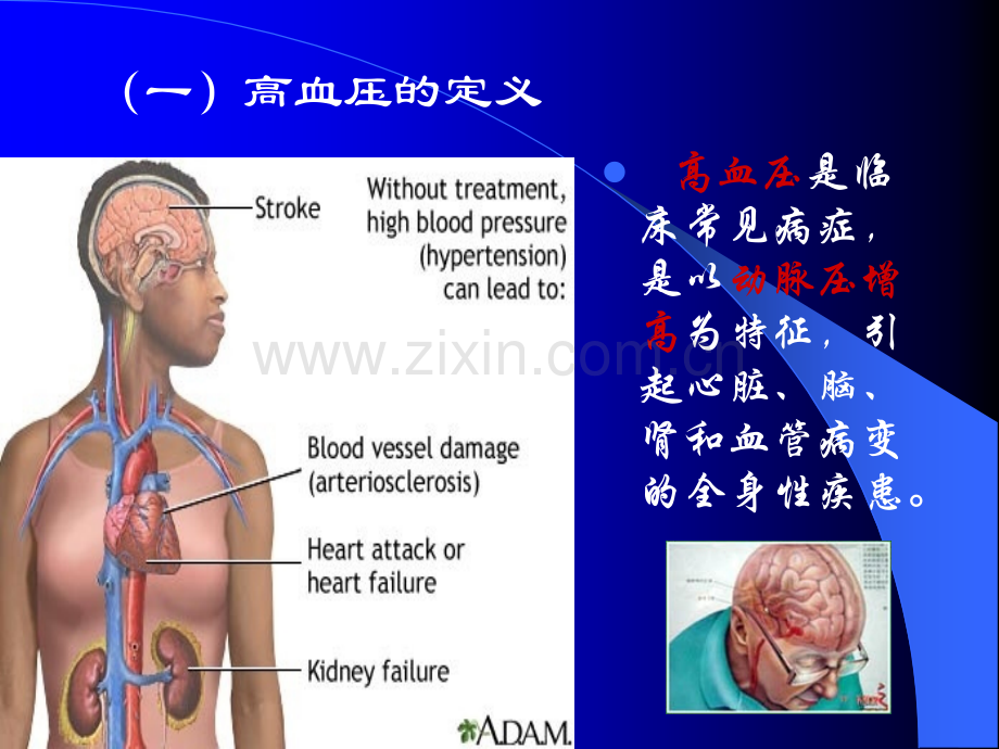 第二十五章-抗高血压药ppt课件.ppt_第3页