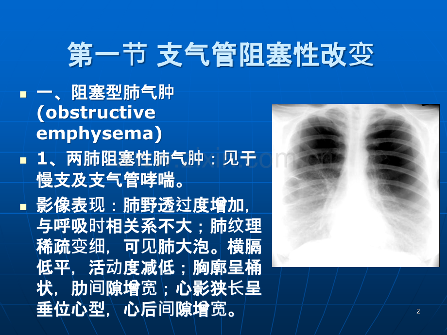 支气管阻塞性改变.ppt_第2页