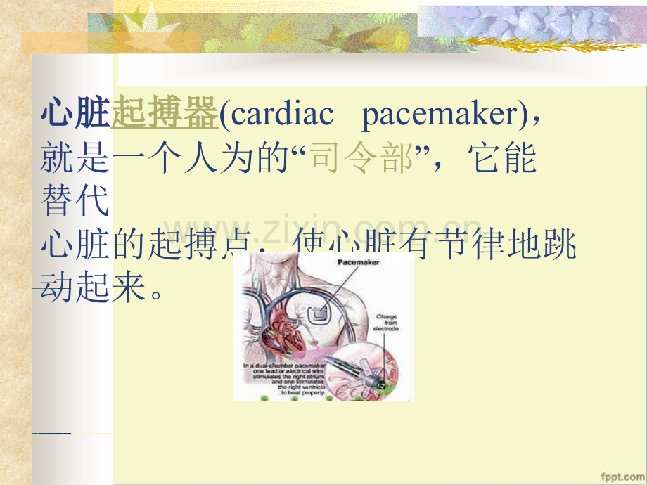 心脏起搏器.ppt_第3页