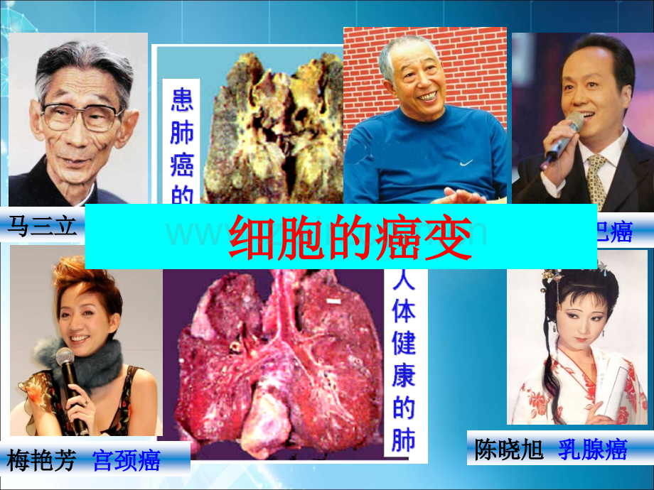 细胞的癌变讲解.ppt_第1页