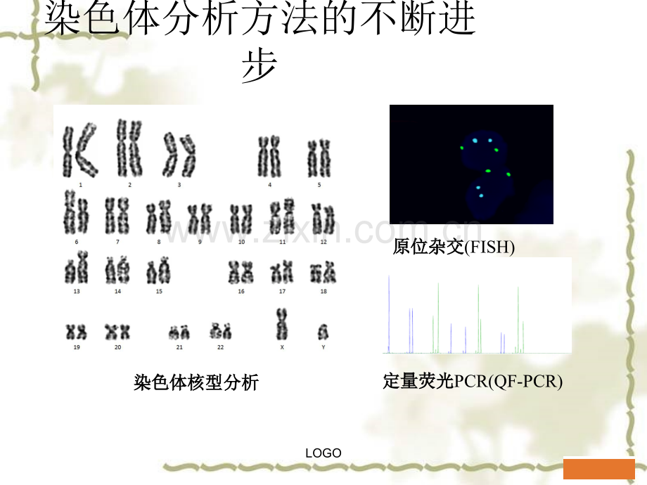 CMA在产前诊断中的应用ppt课件.ppt_第3页