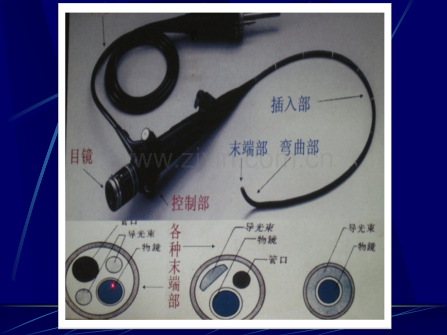 纤维支气管镜在小儿呼吸系统疾病的应用ppt课件.pptx_第3页