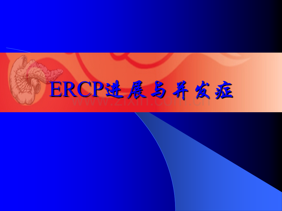 ERCP操作技巧和并发症.ppt_第2页