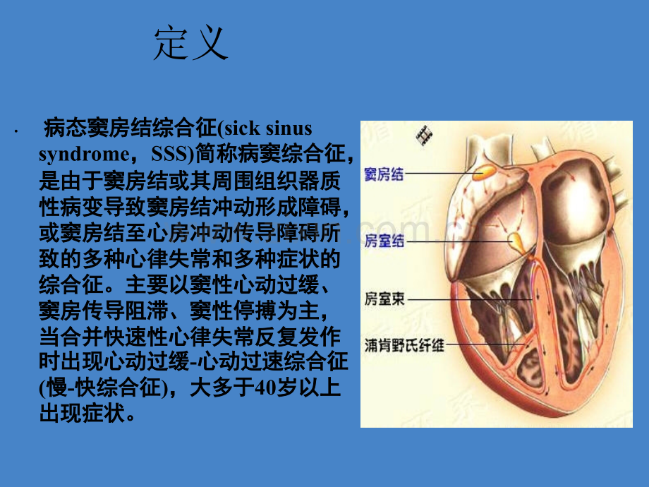 病态窦房结综合症的护理查房ppt课件.ppt_第2页